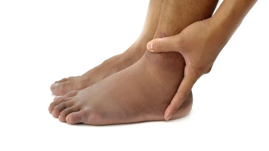 How to Reduce Leg Swelling with At-Home Compression Therapies