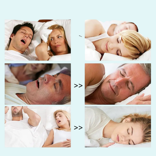 Comparative image promoting nasal strips for snoring relief, showing individuals sleeping with open mouths and disrupted rest on the left, and peacefully sleeping on the right. Highlights the effectiveness of nasal strips in improving airflow and reducing snoring. Ideal for users with nasal congestion, mild sleep apnea, or nighttime breathing issues. Suitable for both men and women. Product aims to enhance sleep quality for both the user and their partner.