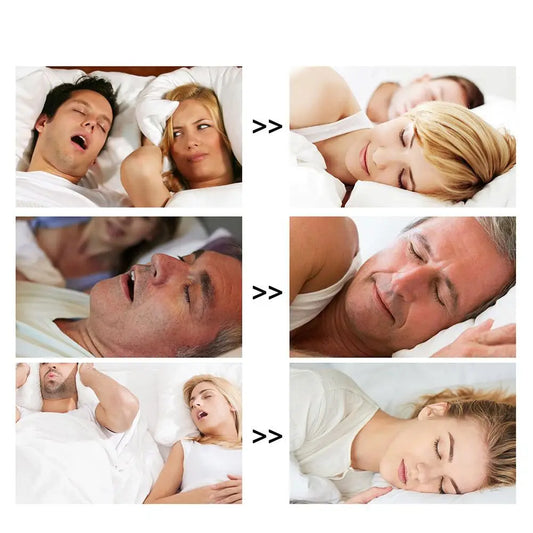Comparative image promoting nasal strips for snoring relief, showing individuals sleeping with open mouths and disrupted rest on the left, and peacefully sleeping on the right. Highlights the effectiveness of nasal strips in improving airflow and reducing snoring. Ideal for users with nasal congestion, mild sleep apnea, or nighttime breathing issues. Suitable for both men and women. Product aims to enhance sleep quality for both the user and their partner.